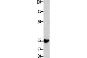 Western Blotting (WB) image for anti-Homeobox A11 (HOXA11) antibody (ABIN2431519) (Homeobox A11 anticorps)