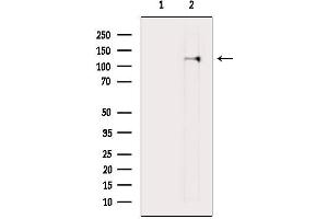 Western blot analysis of lysates from Rat muscle, using PDGF Receptor alpha Mouse Monoclonal Antibody.