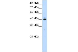 WB Suggested Anti-PAIP1 Antibody Titration:  1. (PAIP1 anticorps  (C-Term))