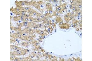 Immunohistochemistry of paraffin-embedded Human liver using CCM2 Polyclonal Antibody at dilution of 1:100 (40x lens). (CCM2 anticorps)