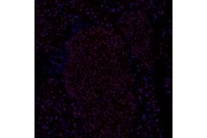 Immunofluorescent analysis of paraformaldehyde-fixed mouse pancreas using Ring1A (ABIN7075467) at dilution of 1: 800