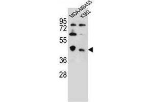 CTBP1 Antibody (C-term) western blot analysis in MDA-MB453,K562 cell line lysates (35µg/lane). (CTBP1 anticorps  (C-Term))