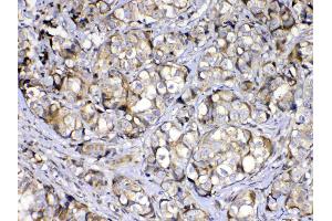 IHC analysis of COPE using anti-COPE antibody . (COPE anticorps  (AA 80-308))