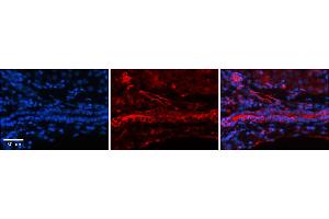 Rabbit Anti-FOLR1 Antibody    Formalin Fixed Paraffin Embedded Tissue: Human Adult liver  Observed Staining: Cytoplasmic,Membrane in bile ducts not in hepatocytes Primary Antibody Concentration: 1:600 Secondary Antibody: Donkey anti-Rabbit-Cy2/3 Secondary Antibody Concentration: 1:200 Magnification: 20X Exposure Time: 0.