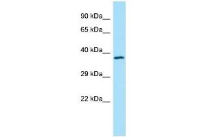 WB Suggested Anti-TMOD4 Antibody Titration: 1. (Tropomodulin 4 anticorps  (Middle Region))