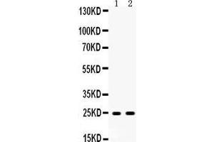 Western blot analysis of Apolipoprotein A I expression in rat liver extract (lane 1) and rat testis extract (lane 2).