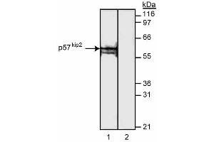 Western blot analysis of p57[Kip2]. (CDKN1C anticorps)