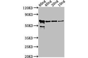 Western Blot Positive WB detected in Recombinant protein All lanes: VP2 antibody at 1:2000 Secondary Goat polyclonal to rabbit IgG at 1/50000 dilution Predicted band size: 62 kDa Observed band size: 62 kDa (VP2 (AA 1-216) anticorps)