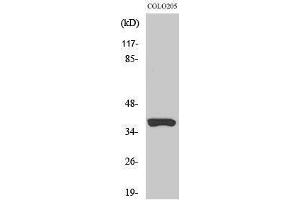 Western Blotting (WB) image for anti-Olfactory Receptor, Family 52, Subfamily B, Member 2 (OR52B2) (Internal Region) antibody (ABIN3186128) (OR52B2 anticorps  (Internal Region))
