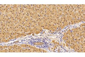 Detection of IL10Rb in Porcine Liver Tissue using Polyclonal Antibody to Interleukin 10 Receptor Beta (IL10Rb)