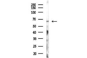 anti-YY1 Transcription Factor (YY1) (pSer365) antibody