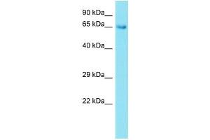 Host: Rabbit Target Name: CNMPD1 Sample Type: Fetal Lung lysates Antibody Dilution: 1. (CNBD2 anticorps  (C-Term))