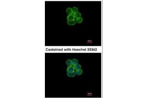 ICC/IF Image Immunofluorescence analysis of methanol-fixed A431, using SGLT1, antibody at 1:500 dilution.