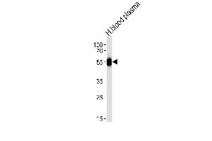 Western blot analysis of lysate from human blood plasma tissue lysate, using SERPINC1 Antibody (C-term) (ABIN390671 and ABIN2840966).