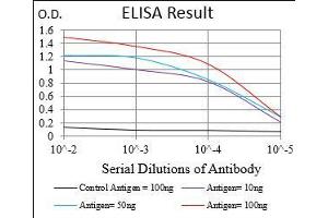 Black line: Control Antigen (100 ng), Purple line: Antigen(10 ng), Blue line: Antigen (50 ng), Red line: Antigen (100 ng), (CAMKII gamma anticorps  (AA 322-481))