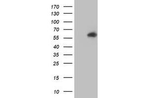 Western Blotting (WB) image for anti-V-Akt Murine Thymoma Viral Oncogene Homolog 1 (AKT1) antibody (ABIN1496557) (AKT1 anticorps)