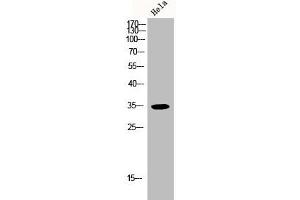 Western Blot analysis of HELA cells using p35 Polyclonal Antibody (CDK5R1 anticorps  (N-Term))