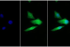 Detection of GLa in Human Hela cell using Polyclonal Antibody to Galactosidase Alpha (GLa) (GLA anticorps  (AA 147-371))