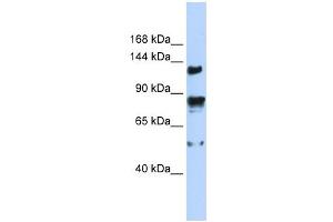 TRPM4 antibody used at 1 ug/ml to detect target protein.