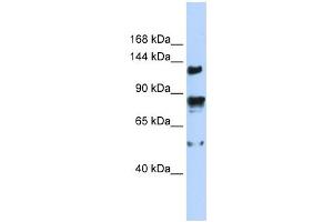 TRPM4 antibody used at 1 ug/ml to detect target protein. (TRPM4 anticorps  (N-Term))