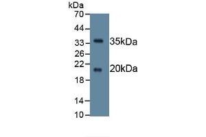 Detection of Recombinant SPINK5, Human using Monoclonal Antibody to Serine Peptidase Inhibitor Kazal Type 5 (SPINK5) (SPINK5 anticorps  (AA 699-976))