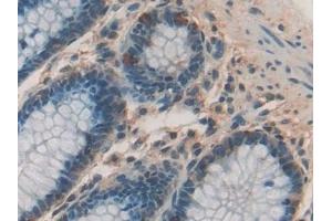 Detection of CHI3L1 in Human Rectum Tissue using Polyclonal Antibody to Chitinase-3-like Protein 1 (CHI3L1) (CHI3L1 anticorps  (AA 112-377))