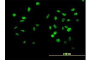 Immunofluorescence of purified MaxPab antibody to CUL4B on HeLa cell. (Cullin 4B anticorps  (AA 1-913))