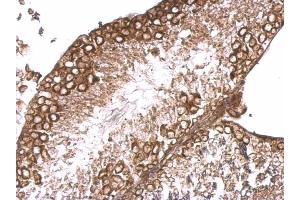 IHC-P Image RBP-Jkappa antibody [C1C3] detects RBP-Jkappa protein at cytosol on mouse testis by immunohistochemical analysis.