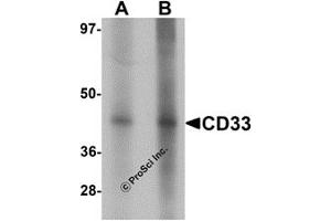 Western Blotting (WB) image for anti-CD33 (CD33) (Middle Region) antibody (ABIN1030903) (CD33 anticorps  (Middle Region))