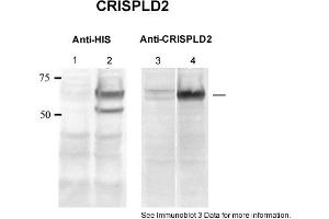 Sample type: 1. (CRISPLD2 anticorps  (N-Term))