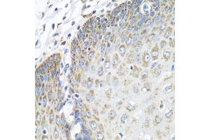Immunohistochemistry of paraffin-embedded human esophagus using TMOD3 antibody (ABIN1683055, ABIN3019135, ABIN3019136 and ABIN6220733) at dilution of 1:100 (40x lens). (TMOD3 anticorps  (AA 1-352))