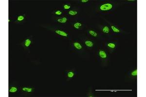 Immunofluorescence of purified MaxPab antibody to NUMA1 on HeLa cell.