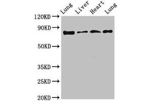 Western Blot Positive WB detected in: Rat lung tissue, Rat liver tissue, Mouse heart tissue, Mouse lung tissue All lanes: LOXL2 antibody at 3. (LOXL2 anticorps  (AA 27-121))