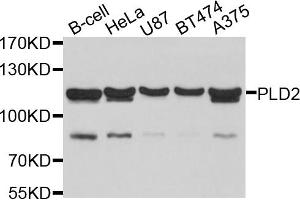 Western blot analysis of extracts of various cell lines, using PLD2 antibody. (Phospholipase D2 anticorps)