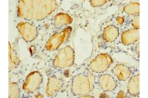 Immunohistochemistry of paraffin-embedded human thyroid tissue using ABIN7169924 at dilution of 1:100 (SCN3A anticorps  (AA 274-400))