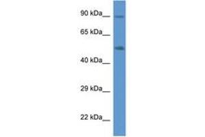 Image no. 1 for anti-Cytochrome P450, Family 2, Subfamily W, Polypeptide 1 (CYP2W1) (AA 260-309) antibody (ABIN6746908)