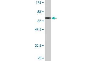 Western Blot detection against Immunogen (73.