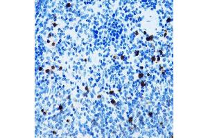 Immunohistochemistry of paraffin-embedded mouse spleen using SPN antibody.