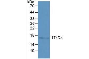Detection of HSPb3 in Human Liver Tissue using Polyclonal Antibody to Heat Shock Protein Beta 3 (HSPb3)