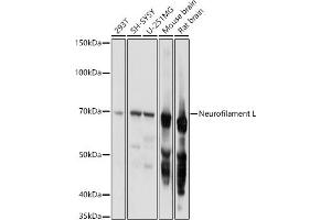 Western blot analysis of extracts of various cell lines, using Neurofilament L antibody (ABIN3020808, ABIN3020809, ABIN3020810 and ABIN6213733) at 1:1000 dilution. (NEFL anticorps  (AA 400-543))