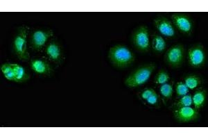 Immunofluorescent analysis of A549 cells using ABIN7144062 at dilution of 1:100 and Alexa Fluor 488-congugated AffiniPure Goat Anti-Rabbit IgG(H+L) (ZFAND6 anticorps  (AA 1-208))