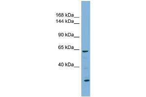 WB Suggested Anti-KL Antibody Titration:  0. (Klotho anticorps  (N-Term))