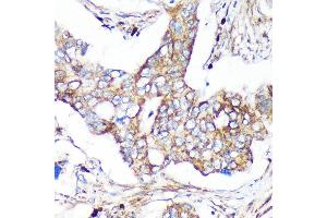 Immunohistochemistry of paraffin-embedded Human colon carcinoma using C Rabbit pAb (ABIN7266547) at dilution of 1:100 (40x lens).