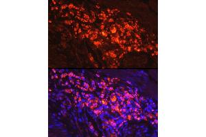 Immunofluorescence analysis of human colon carcinoma cells using Myeloperoxidase (MPO) Rabbit pAb (ABIN6128315, ABIN6143964, ABIN6143965 and ABIN6217844) at dilution of 1:50 (40x lens). (Myeloperoxidase anticorps  (AA 50-310))
