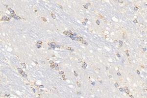 Immunohistochemistry analysis of paraffin-embedded rat brain using,ME2 (ABIN7074757) at dilution of 1: 6000