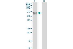 Western Blot analysis of HDAC1 expression in transfected 293T cell line by HDAC1 monoclonal antibody (M06), clone 1D6. (HDAC1 anticorps  (AA 1-482))