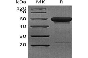 Western Blotting (WB) image for CD160 (CD160) protein (Fc Tag) (ABIN7321007) (CD160 Protein (CD160) (Fc Tag))