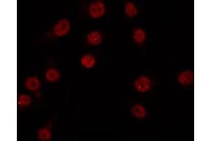 ABIN6266816 staining COS7 by IF/ICC. (XRN2 anticorps)