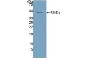 Detection of Recombinant CLEC4L, Human using Polyclonal Antibody to Cluster Of Differentiation 209 (CD209) (DC-SIGN/CD209 anticorps  (AA 70-404))