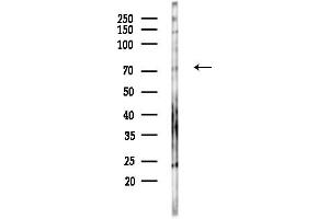 anti-Transforming Growth Factor, beta-Induced, 68kDa (TGFBI) (N-Term) antibody